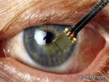 نجاح تجربة زراعة شبكية إلكترونية للمصابين بالعمى