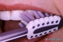 أطباء يحذرون من تنظيف الأسنان بعد الطعام مباشرة 