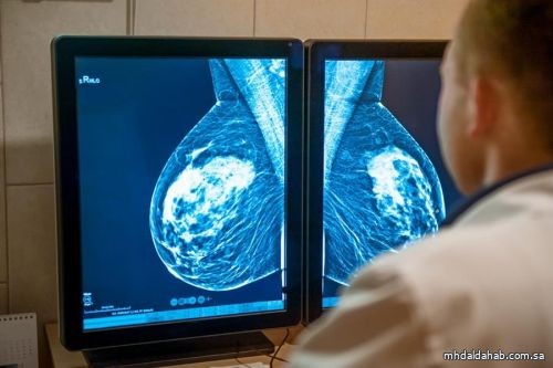 هل يتسبب جهاز الكشف عن سرطان الثدي في الإصابة بالمرض؟ "الصحة" تجيب