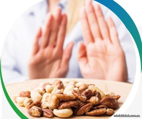 «الصحة» تطلق مبادرة «الموضوع حساس» للتوعية بالحساسية الغذائية