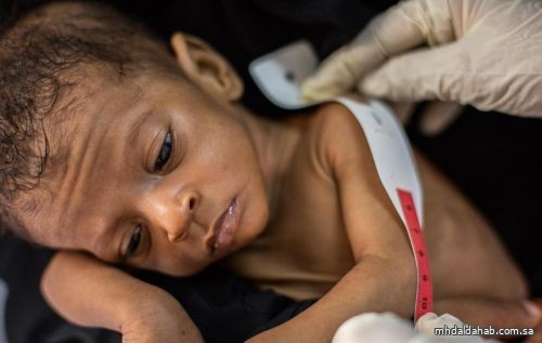 4 ملايين طفل وامرأة يعانون من سوء التغذية في السودان