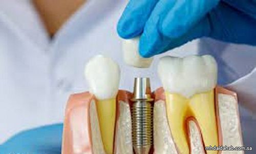 مبتعث يفوز بأفضل علاج متكامل لحالة معقدة في "استعاضة وزراعة الأسنان"