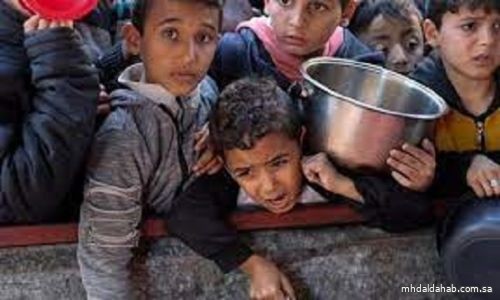 وفاة 27 طفلًا في غزة بسبب سوء التغذية