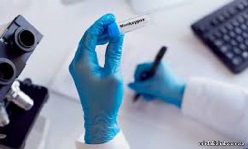 زيمبابوي تسجل أول حالتي إصابة بفيروس جدري القردة